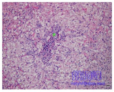 猫脂肪肝（Fatty Liver Syndrome ，FLS）