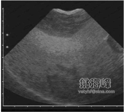猫脂肪肝（Fatty Liver Syndrome ，FLS）