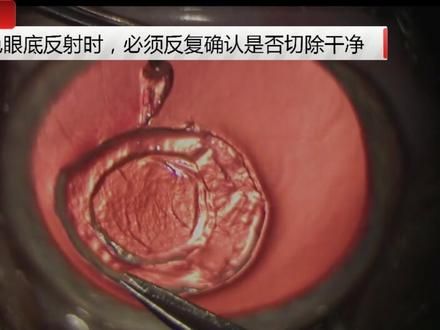 红色眼底反射下切除坏死灶,难度系数大很多#动物眼科医生