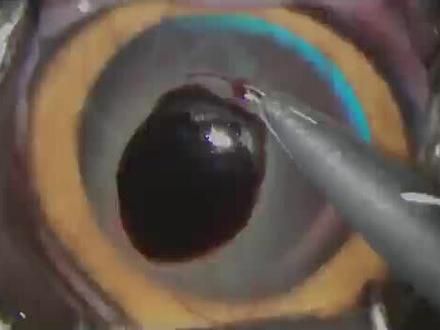 不会留下任何痕迹的角膜腐骨手术#角膜腐骨 #动物眼科医生
