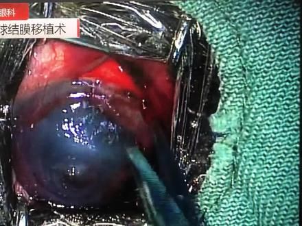 为眼科基础班的学员准备解析用的手术全程实况视频,课后可由学员拷走带回慢慢学习#动物眼科医生