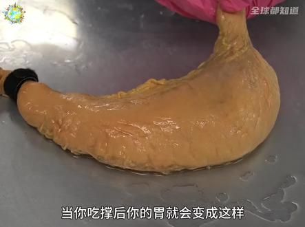 当你胡吃海喝暴饮暴食时，你的肠胃都会经历什么？ #涨知识 #科普 #科普一下 #科普动画