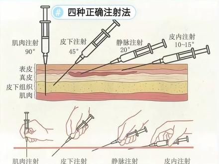 认真看几遍，就知道怎么给狗打针了#养狗经验分享 #科学养宠攻略 #狗狗