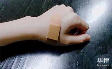 饲养动物致人损害责任如何判定