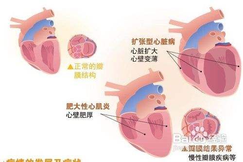 正确认识犬心脏病