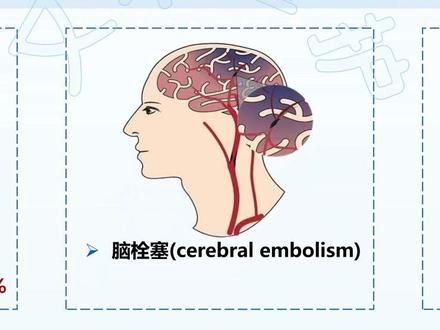 基于循证的护理个案ppt，真的绝了！#护士懂护士 #护士 #不懂就问有问必答 #循证护理 #护理个案