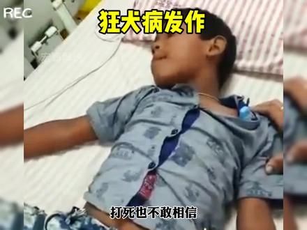狂犬病发作的真实一幕#真实一幕 #狂犬病 #狂犬病的科普
