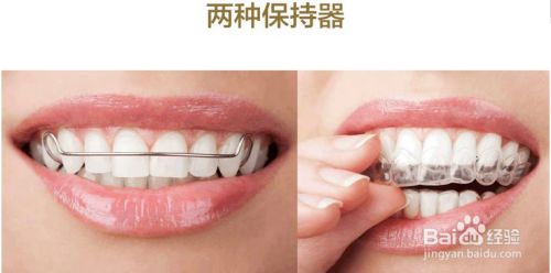 牙齿矫正的基础知识
