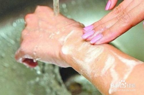 被宠物抓伤或咬了怎么办？