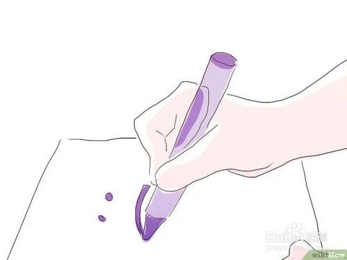 如何防治儿童抑郁症？