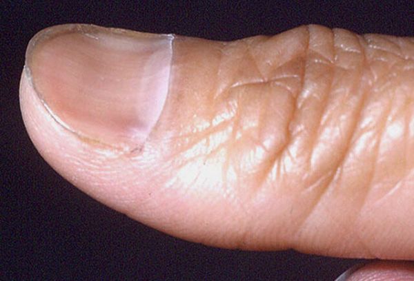 fig9.jpg
