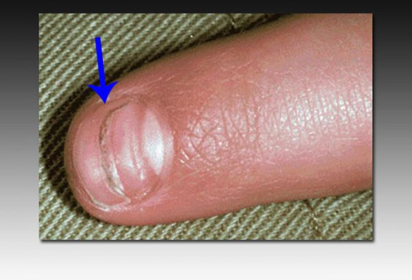fig16.jpg