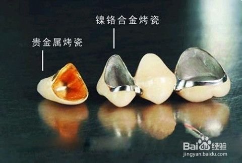 牙齿劈裂怎么办?
