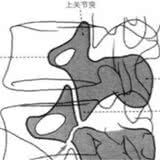 腰痛的原因竟然是身体里的小狗出了问题?