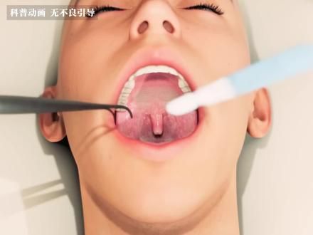 喉咙最后面是什么?它有什么作用? #科普动画 #人体奥秘