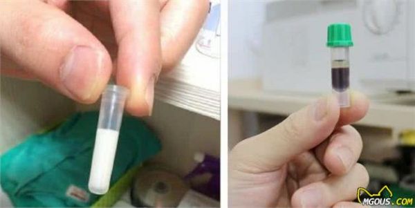宠物科普：小狗肥胖可引起高脂血病，病因、治疗及预防措施分析