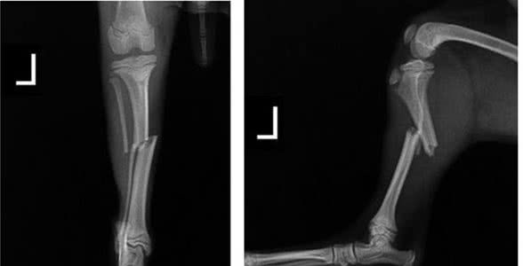 狗狗胫腓骨骨折了?!一例幼犬胫腓骨骨折内固定治疗体会