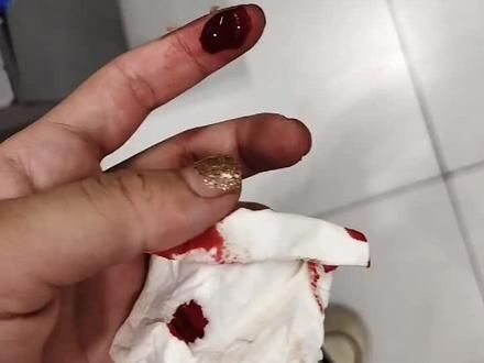已到货,直接被仓鼠咬了一口,#金丝熊 只好再去破伤风有点不放心。