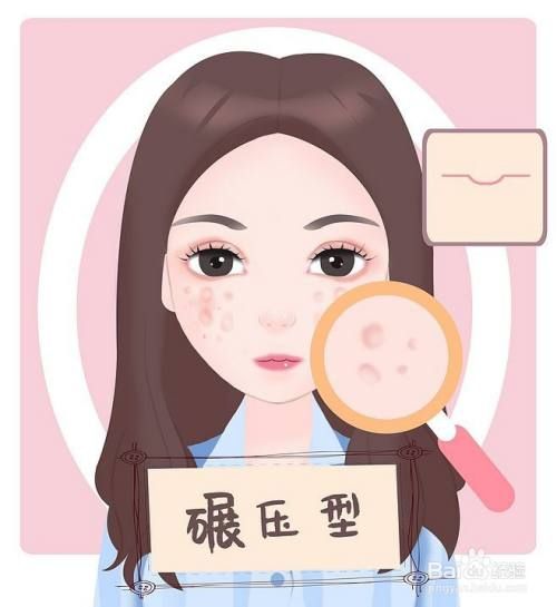 痘坑类型图片