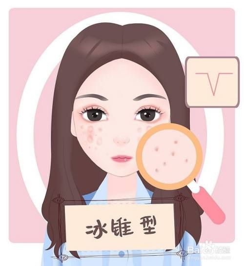 痘坑类型图片