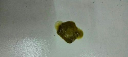 狗狗得了球虫病该吃什么（给宠物科普一下）