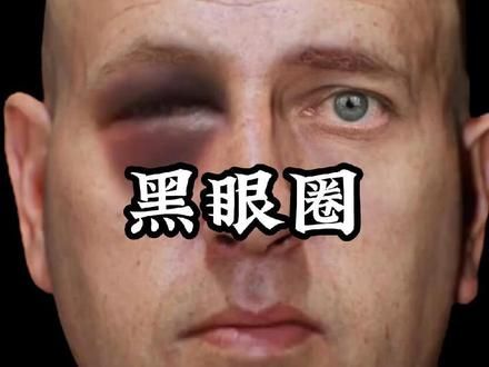 被人揍到眼睛，为什么会变成熊猫眼？ #科普一下 #冷知识 #人体奥秘 #肌肉 #黑眼圈