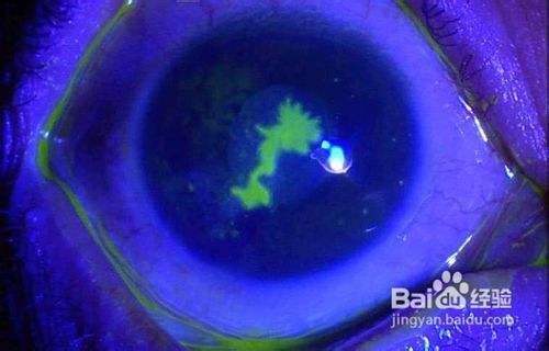 狗狗眼睛角膜炎怎么办