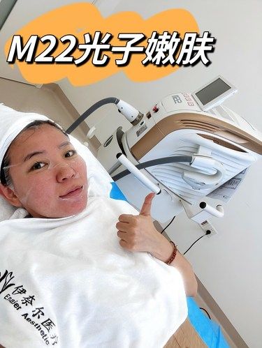 变美高性价比，M22光子嫩肤