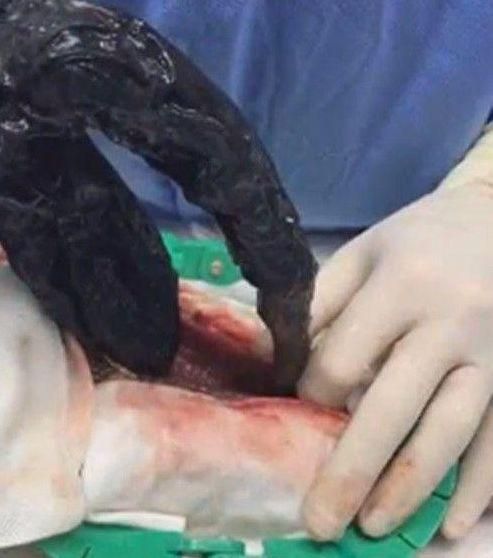 上班族留宠物蛇在家！惊见蛇肚鼓胀，请兽医剖腹后吓一跳