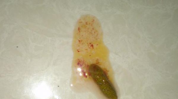 宠物拉肚子的原因和治疗方法（宠物拉肚子的原因和治疗方法）