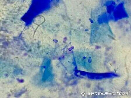 马拉色菌