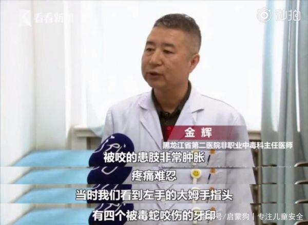 吓人！15岁男孩网购这个当宠物被咬伤，三天才脱离危险！