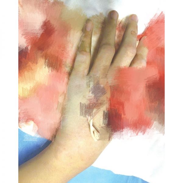 13岁男孩攒钱网购宠物蛇，玩蛇被咬进ICU：医生：竹叶青有毒