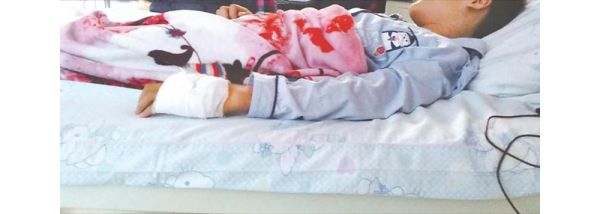13岁男孩攒钱网购宠物蛇，玩蛇被咬进ICU：医生：竹叶青有毒