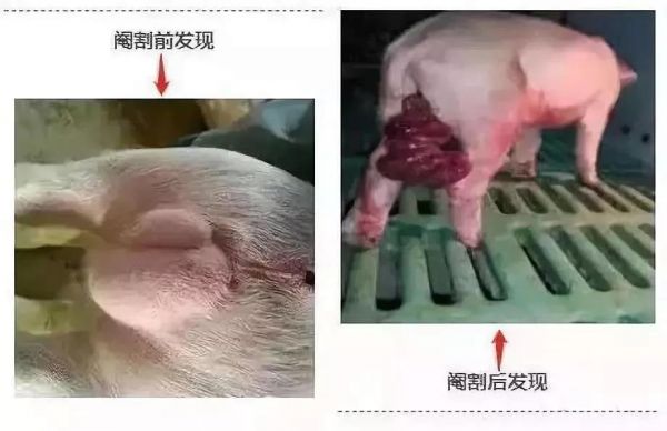 猪脐疝