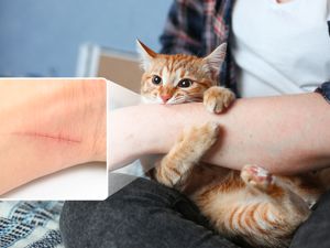 被猫咬伤