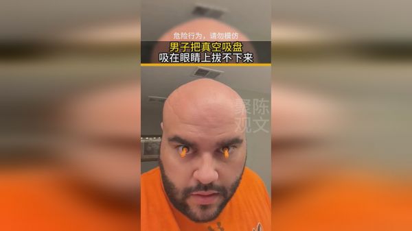 男子把真空吸盘吸在眼睛上拔不下来