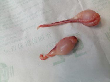 蜱虫的死穴。