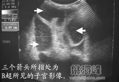 猫子宫蓄脓（feline pyometra）