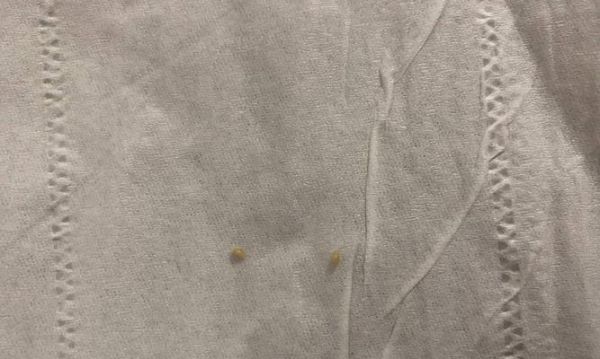 宠物猫身上为什么会有虫（了解宠物猫身上虫的种类及预防方法）
