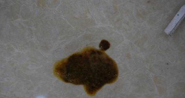 宠物狗拉肚子该怎么办（狗狗拉肚子的原因及预防措施）