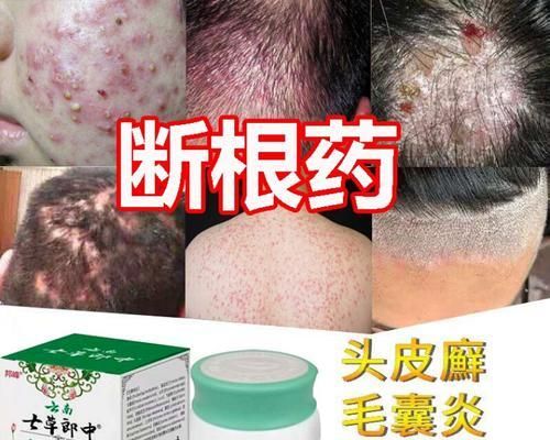 小宠物的健康问题——大白熊拉肚子怎么办（关于宠物拉肚子的常见症状、注意事项与治疗方法）