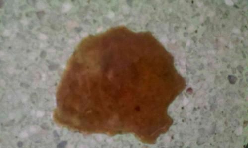 如何应对宠物狗的拉稀和水肚子（实用方法帮你轻松解决宠物狗的消化问题）