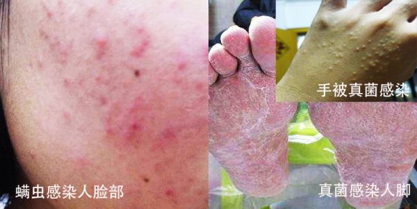 让狗狗皮肤重回健康美丽的优选方案 第 10 张