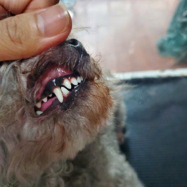 千万不要去为了去牙结石做麻醉！选择无麻醉洁牙