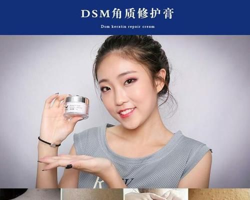 鱼鳞发黑是疾病的表现吗？哪种药膏治疗效果好？
