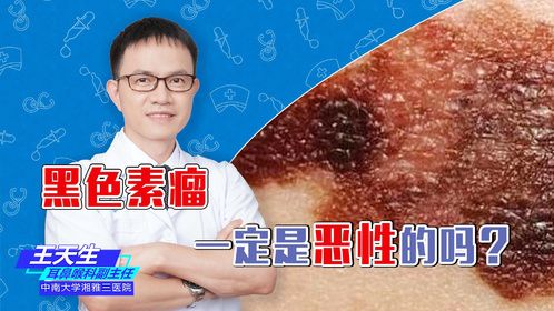 黑色素瘤一定是恶性的吗？