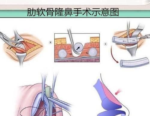 狗狗口鼻瘘怎么办？（了解狗狗口鼻瘘的症状与治疗方法）