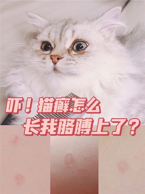“猫癣克星，宠物护理必备！”