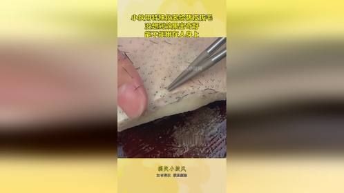 小伙用特殊仪器给猪皮拔毛，没想到效果出奇好，能不能用在人身上